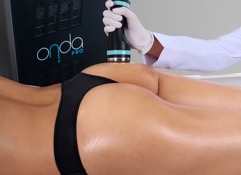 Onda Pro Glute Treatment Onda Pro Glute Treatment