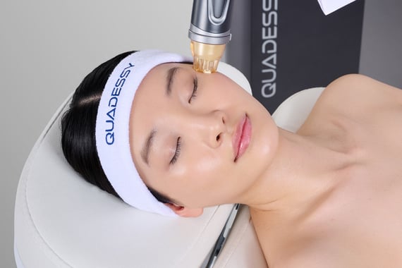 patient receiving rfmn treatment with quadessy device