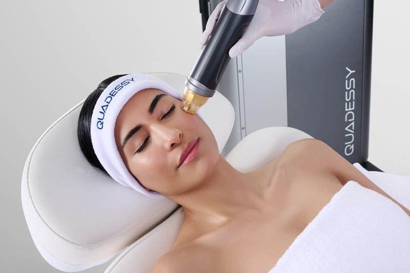 patient receiving quadessy treatment