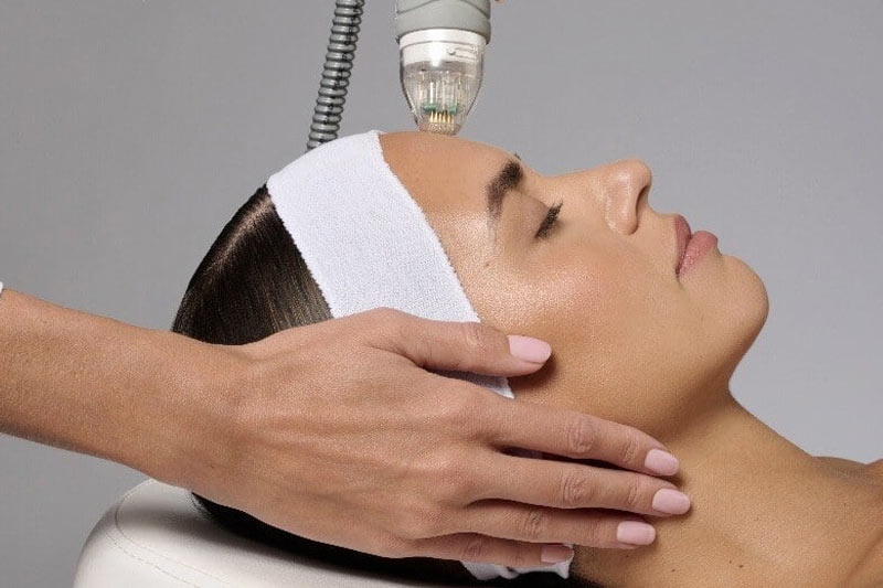 patient receiving vybe rf treatment