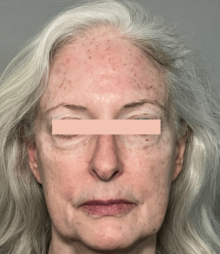 Before_MaysPlasticSurgery (1)-1-1-1