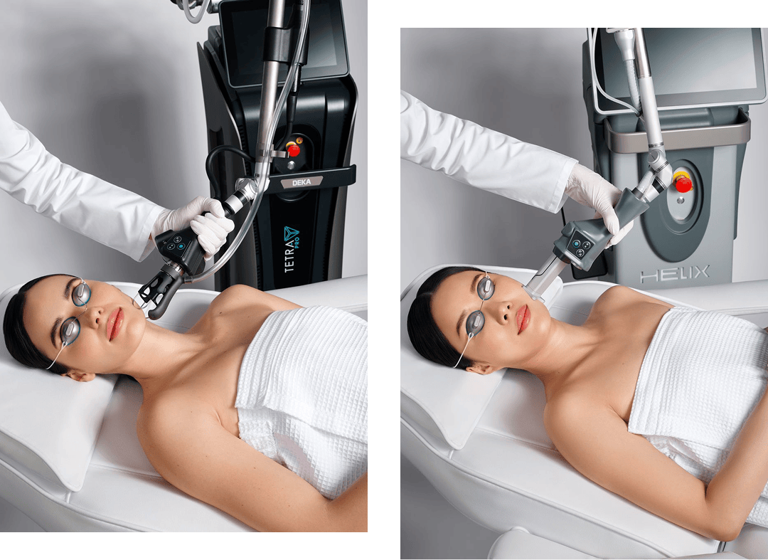 Woman patient receiving Tetra and Helix treatment in separate photos