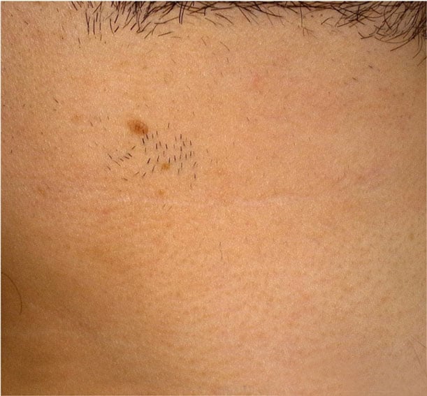 aliya-after-photo