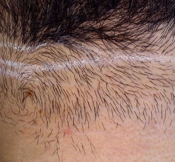 aliya-before-photo