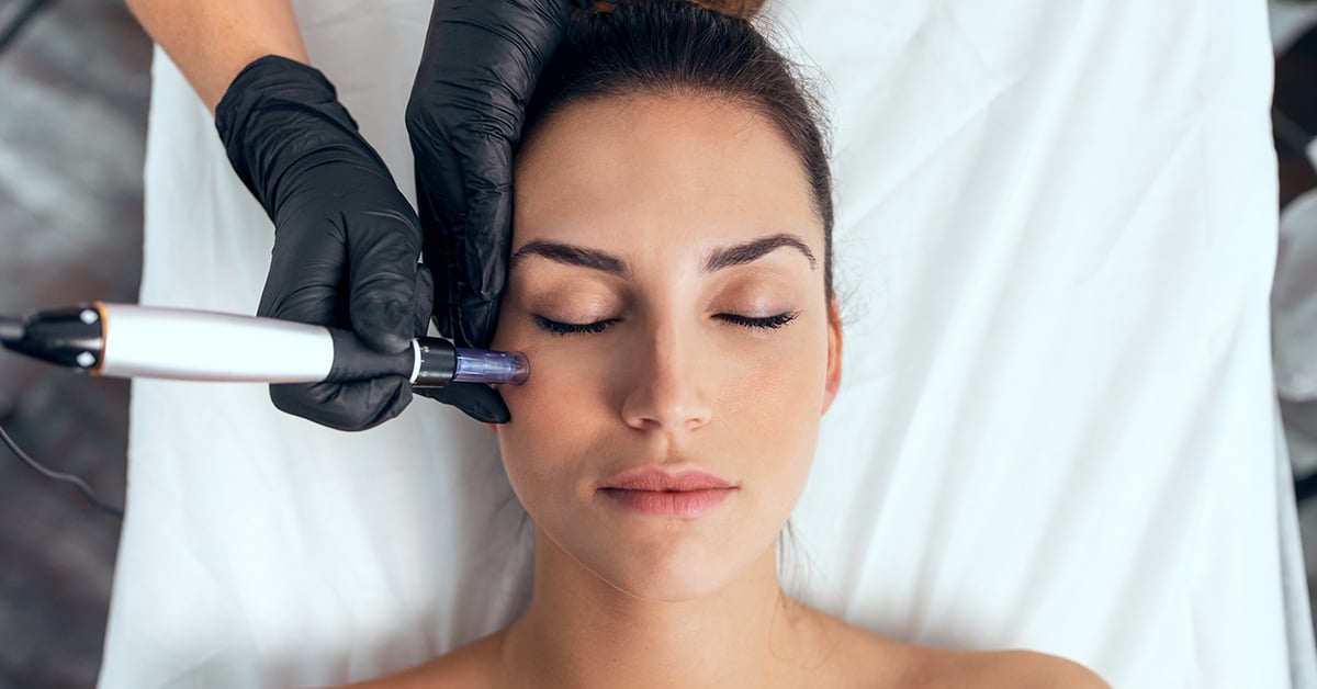woman receiving rf microneedling facial treatment