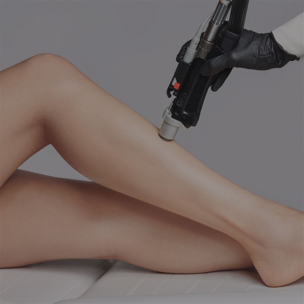 woman-getting-microneedling-treatment-on-her-leg